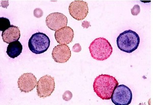 写真5：細胞の形では見分けがつかない細胞も、免疫染色で染め分けることができる。